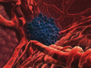 cancer cell.jpg